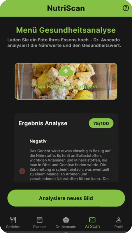 Screenshot des "NutriScan"-Features, das die Analyse eines Essensbildes zeigt, das eine Bewertung von 75/100 erhalten hat, mit einer negativen Beschreibung der Nährwertzusammensetzung.